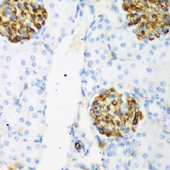 CSRNP1 / AXUD1 Antibody