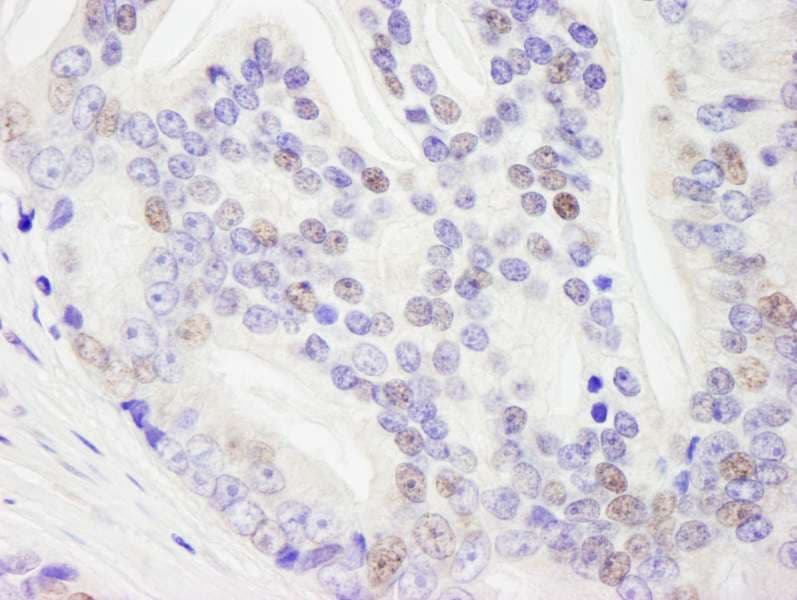 DHX9 Antibody (aa200-250)