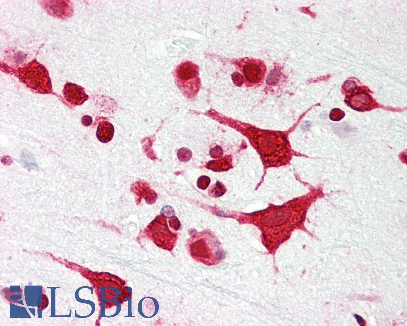 PathPlus™ NPM1 / NPM / Nucleophosmin Antibody
