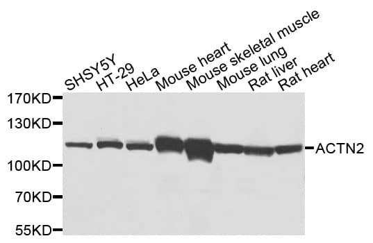 ACTN2 Antibody