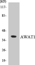 Polyclonal Rabbit anti-Human AWAT1 / DGAT2L3 Antibody (aa250-299, WB)