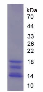 Rat IL15 Protein (Recombinant His)