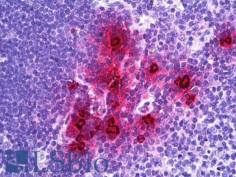 IHC-plus™ Polyclonal Goat anti-Human DEFA1 / Defensin Alpha 1 Antibody (aa50-63, IHC, WB)