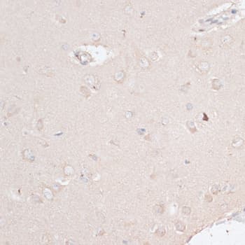 ABCF2 Antibody