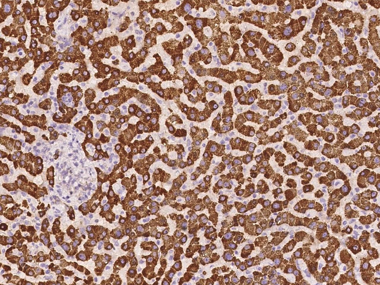 SLC38A1 / NaT2 Antibody