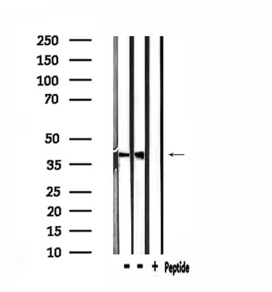 CLN6 Antibody