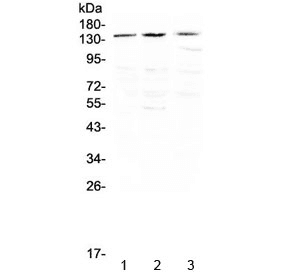 Polyclonal Rabbit anti-Human NTRK1 / TrkA Antibody (WB)