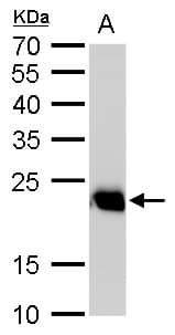 IHC-plus™ RAB6A / RAB6 Antibody (aa1-208)