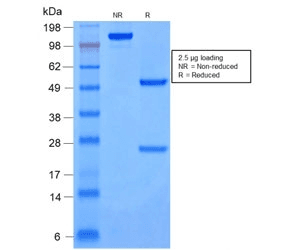 Cytokeratin 8+18 Antibody (clone rKRT8.18/1346)