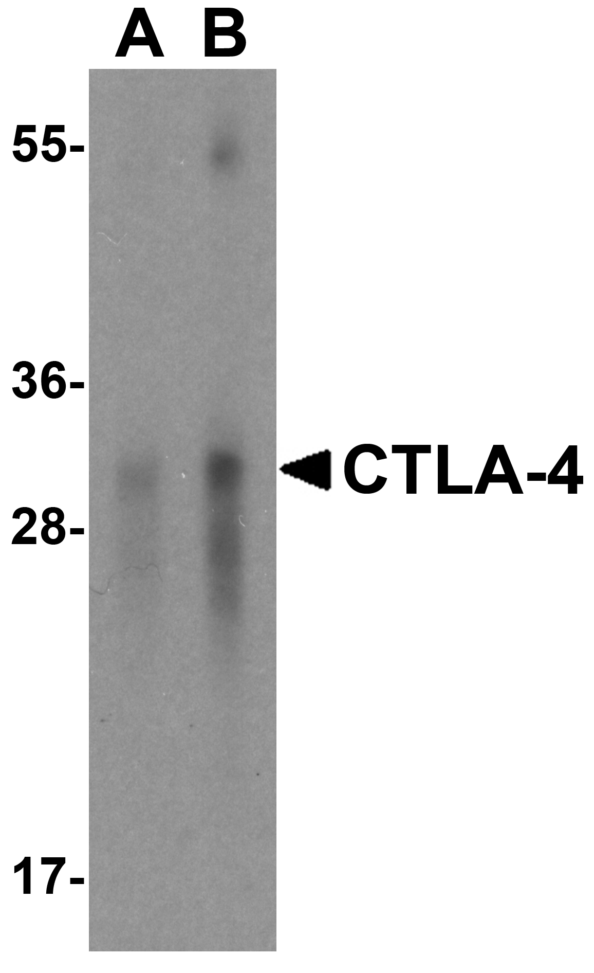 CTLA4 / CD152 Antibody (clone 2G10)