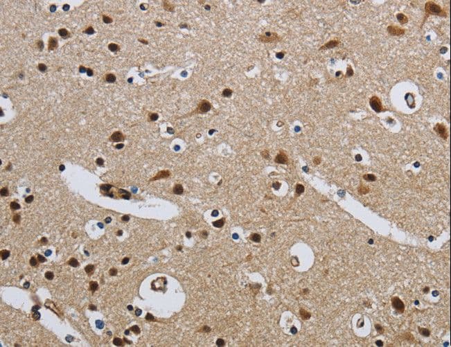 CMTM8 Antibody