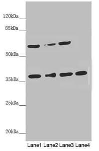 Polyclonal Rabbit anti-Human SPFH2 / ERLIN2 Antibody (IHC, WB)
