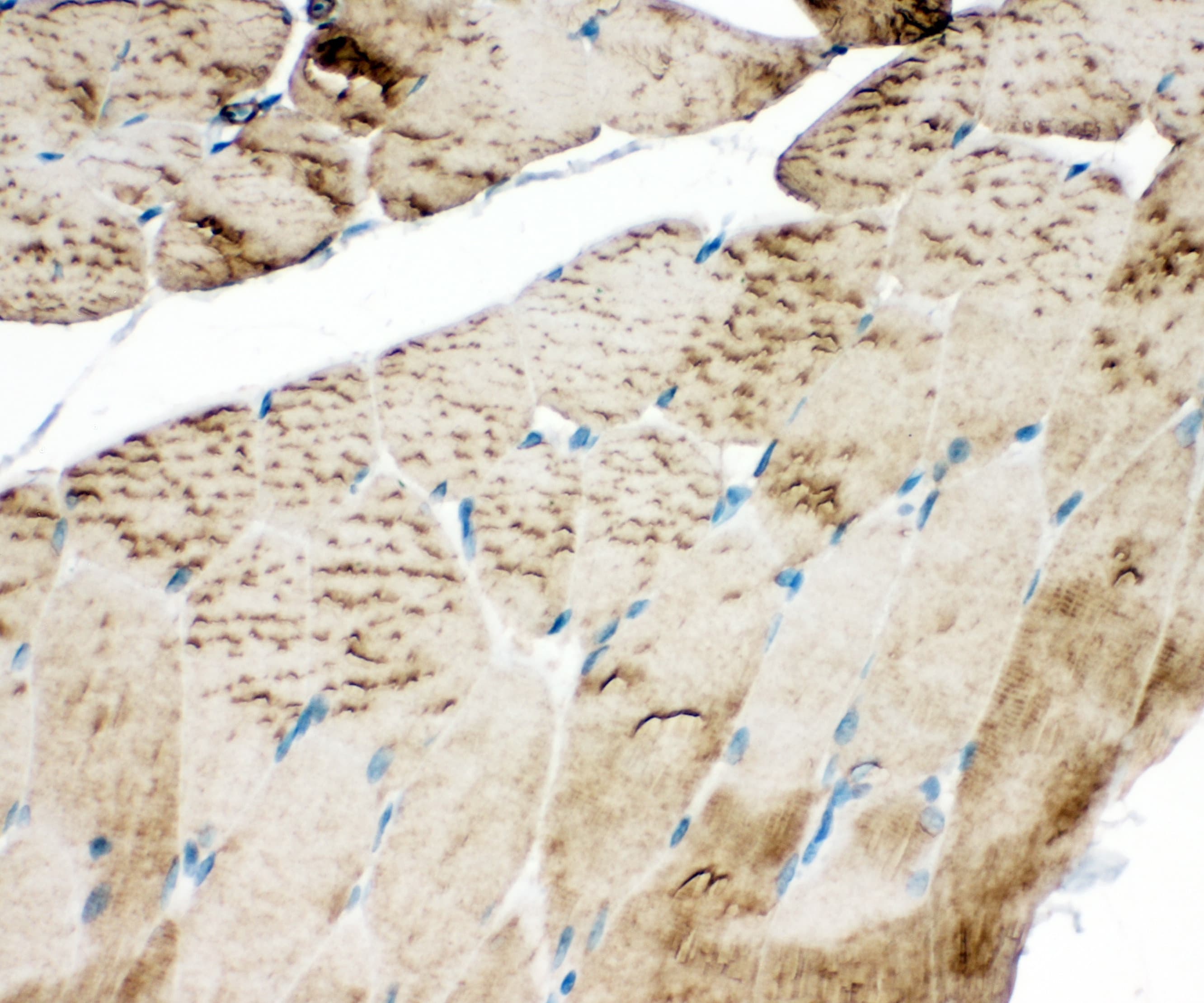ATP2A1 / SERCA1 Antibody (aa665-680)