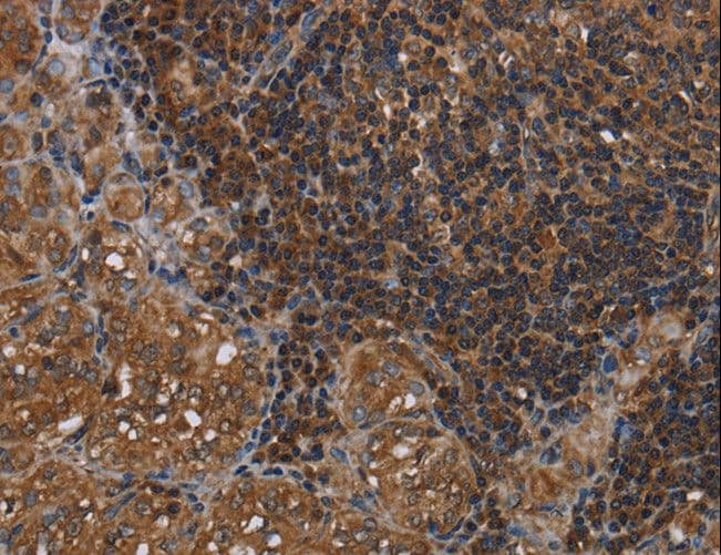 Polyclonal Rabbit anti-Human HOMER2 / Homer 2 Antibody (IHC)