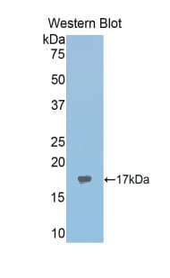 ACO1 / Aconitase Antibody (aa458-586, PE)