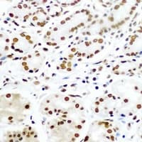 Polyclonal Rabbit anti-Human TIP49 / RUVBL1 Antibody (IHC, IF, WB)