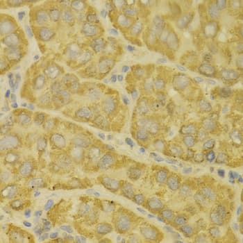IHC-plus™ Polyclonal Rabbit anti-Human MAOA / Monoamine Oxidase Antibody (IHC, WB)