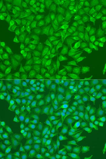 c-CBL Antibody