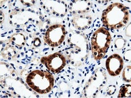 QPRT Antibody (clone OTI7A8)