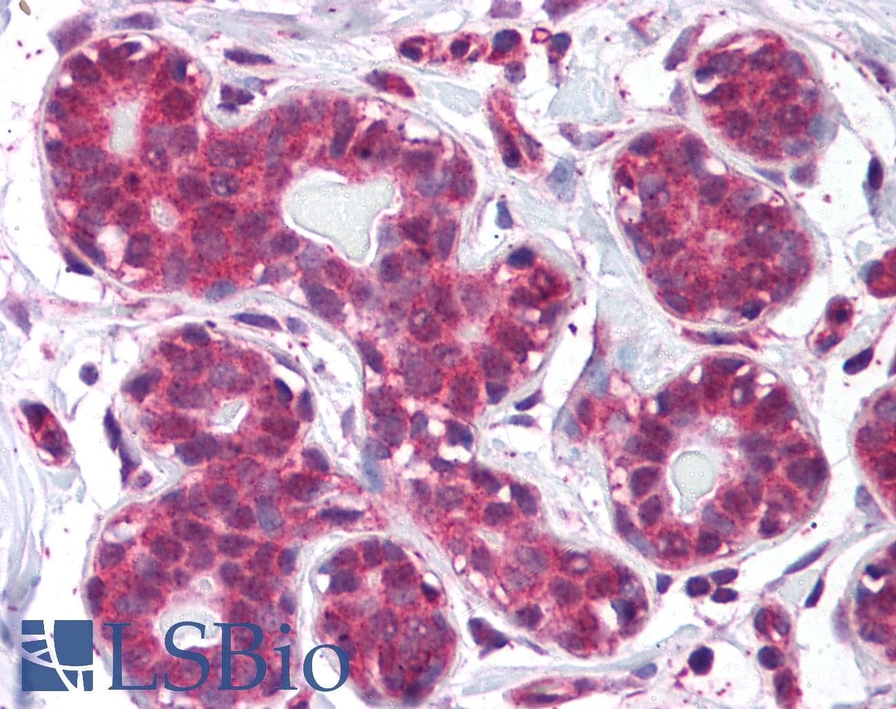 IHC-plus™ Polyclonal Rabbit anti-Human STAT5B Antibody (N-Terminus, IHC, WB)