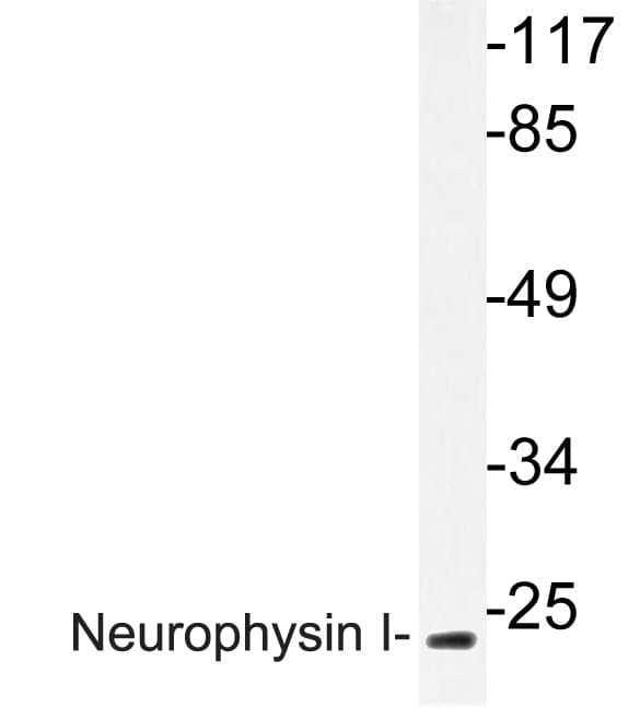 Neurophysin I Antibody (aa40-89)