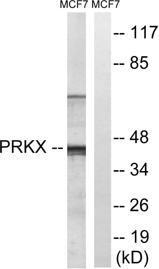 PRKX Antibody (aa251-300)