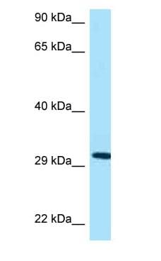 Prohibitin 2 / PHB2 Antibody (aa191-240)