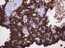 HSPD1 / HSP60 Antibody (clone OTI3G10)