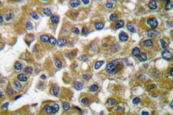 MMP3 Antibody (Ser453)