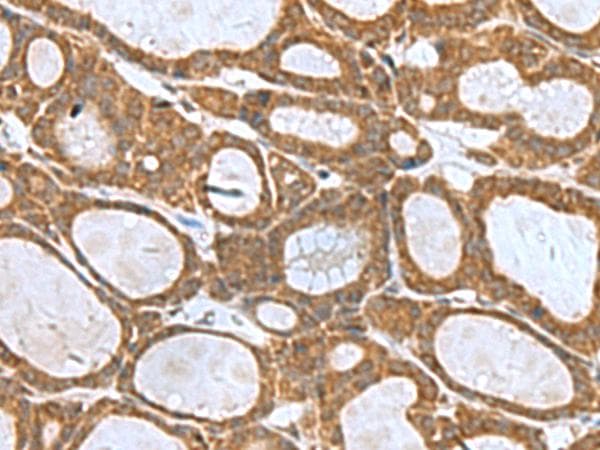 KIF2A Antibody