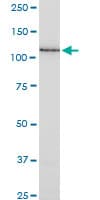 Monoclonal Mouse anti-Human SSH1 Antibody (clone 1D2, WB)