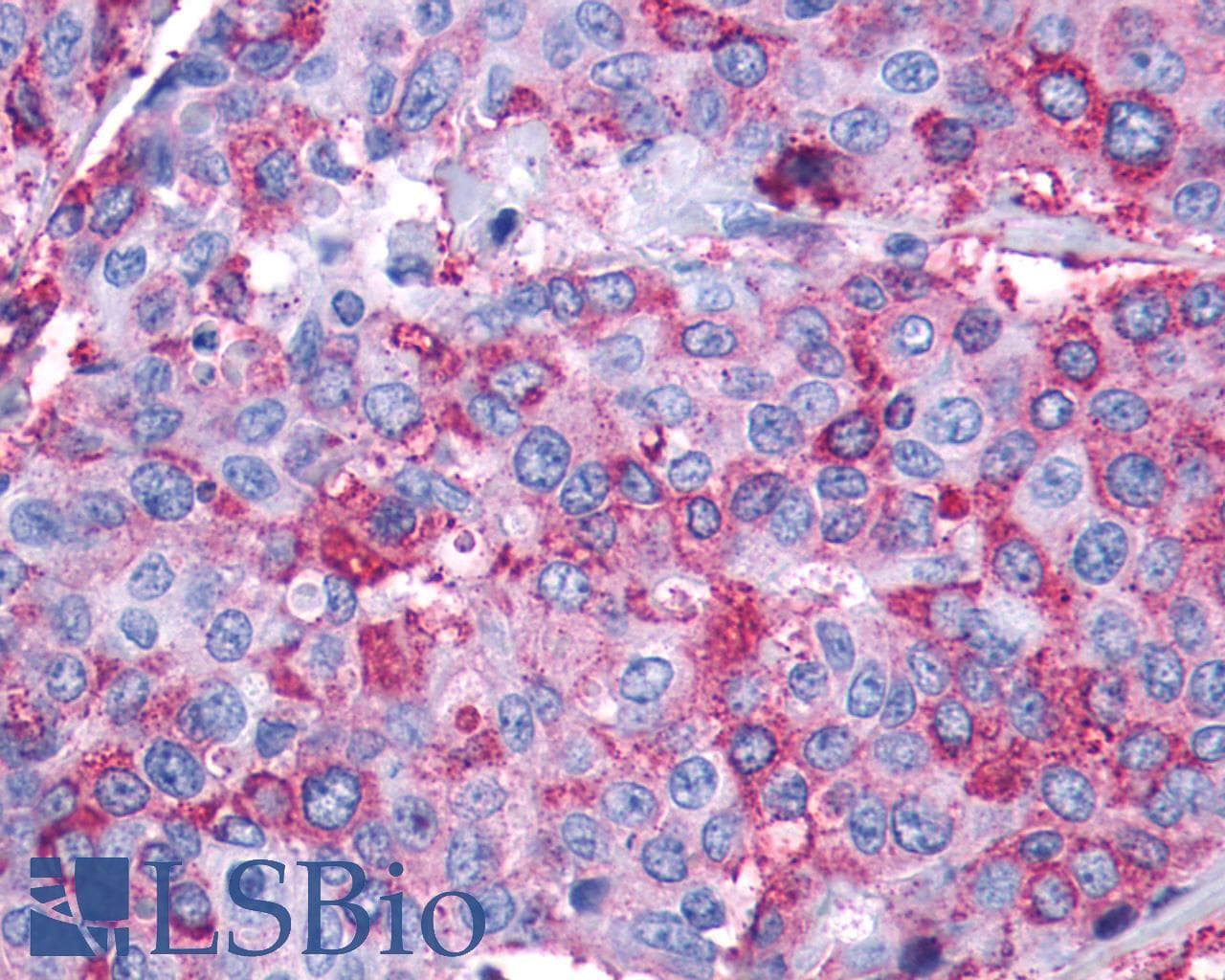 PathPlus™ Polyclonal Rabbit anti-Human LTB4R2 / BLT2 Antibody (C-Terminus, IHC)