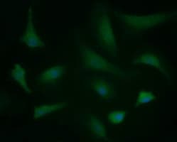 BBOX1 / BBOX Antibody (clone OTI2C8)
