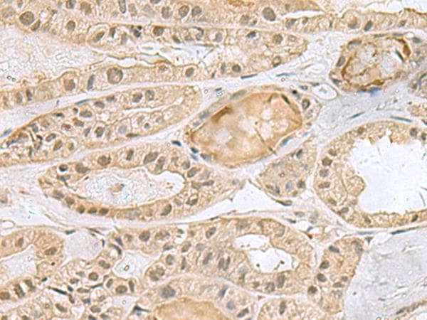PCBD1 / PHS Antibody