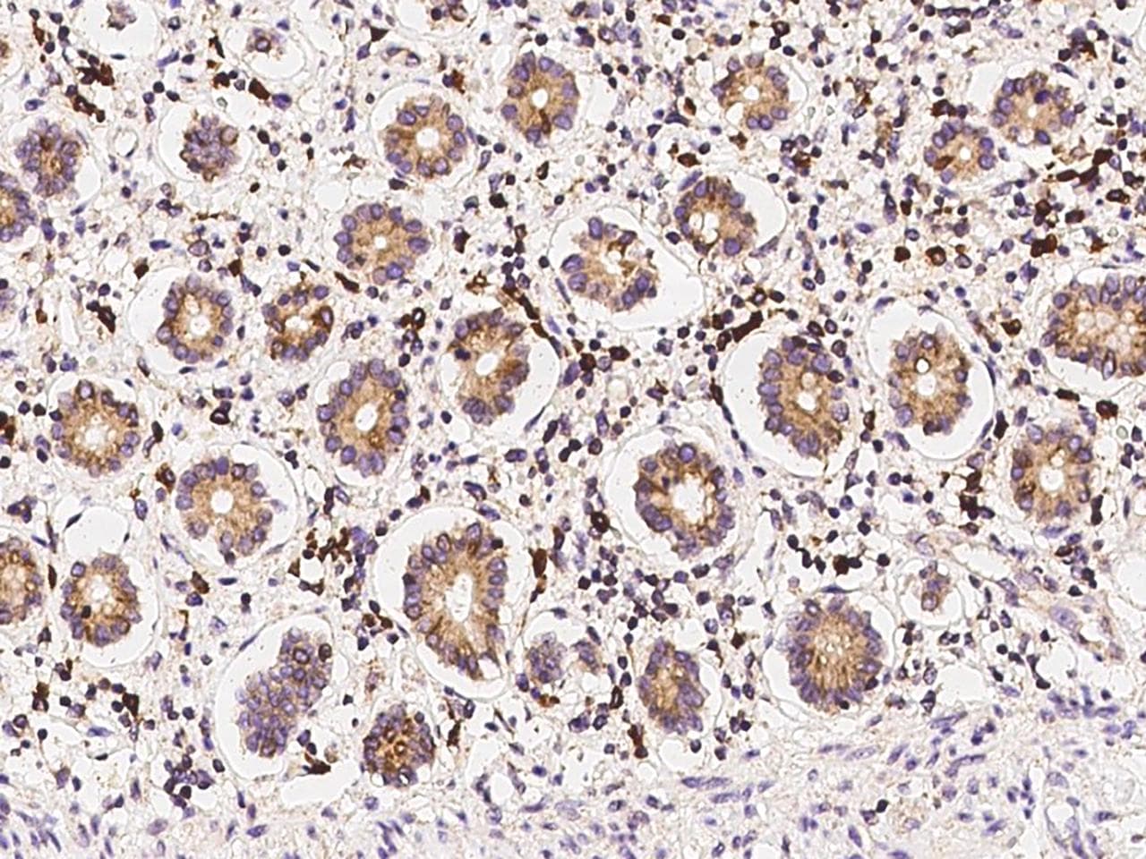 DERL1 / Derlin 1 Antibody