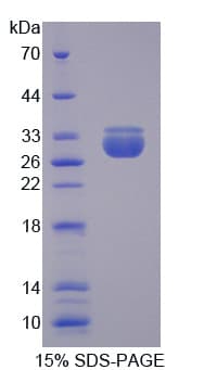 Human TNPO2 / Importin Protein (Recombinant His)