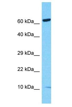 Polyclonal Rabbit anti-Human S100Z Antibody (aa1-50, WB)