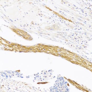 Polyclonal Rabbit anti-Human Vasohibin 1 / VASH1 Antibody (IHC, WB)