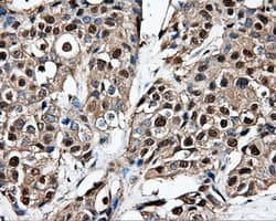 PSMC3 Antibody (clone OTI8D6)