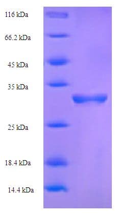 Human F5 / Factor Va Protein (Recombinant His-SUMO)