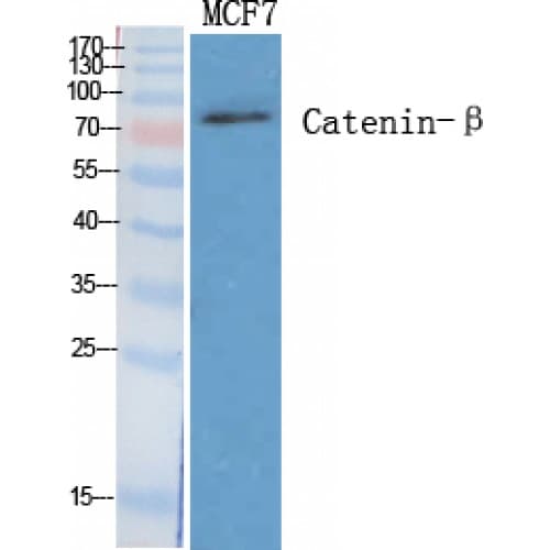 CTNNB1 / Beta Catenin Antibody (10-90 aa)