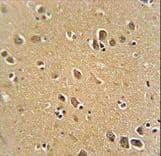 Polyclonal Rabbit anti-Human RFT1 Antibody (aa513-541, IHC, WB)