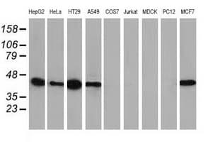 VASP Antibody (clone OTI1C3)