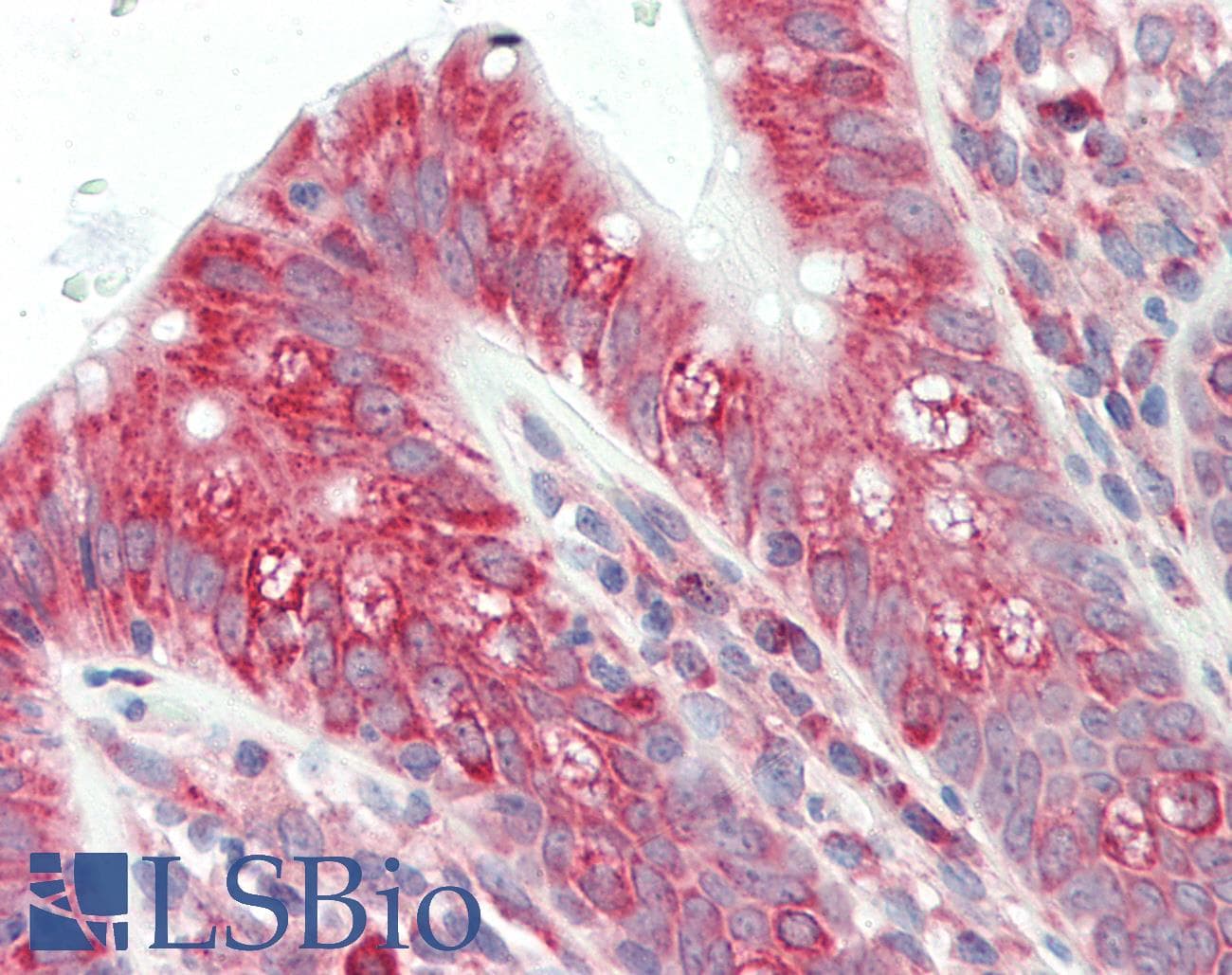 UBE2K / LIG Antibody (C-Terminus)