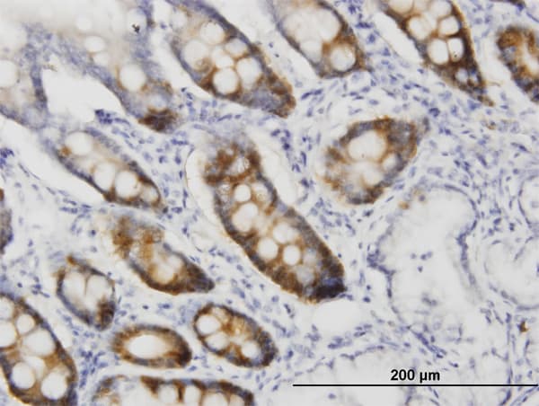 Monoclonal Mouse anti-Human CDK1 / CDC2 Antibody (clone 1A4-1A9, IHC, IF, WB)