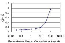 MCAT Antibody (clone 2F2)