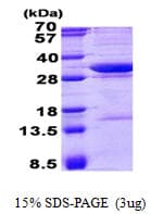 Human NCEH1 / AADACL1 Protein (Recombinant His)