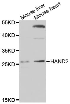 IHC-plus™ Polyclonal Rabbit anti-Human DHAND / HAND2 Antibody (IHC, IF, WB)