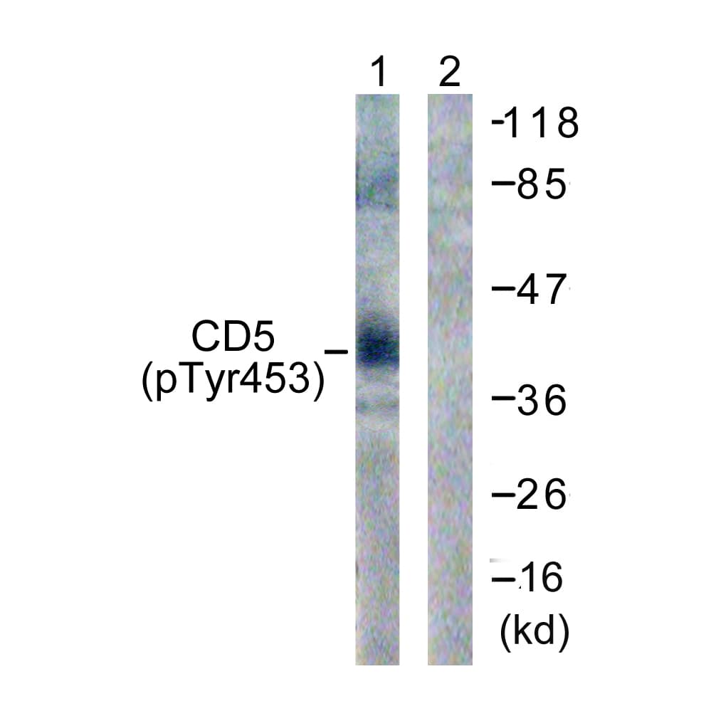 Polyclonal Rabbit anti-Human CD5 Antibody (phospho-Tyr453, IF, WB)