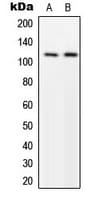 MPRIP / RIP3 Antibody (Internal)